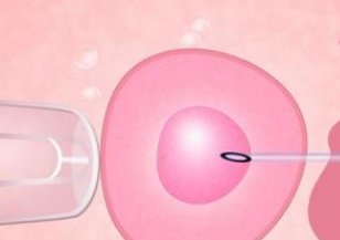 做三代试管男人请假时间并不长，具体需要几天视情况而定